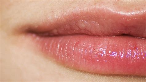 Herpes On Lips Beginning Stages Lipstutorial Org