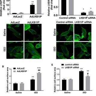 Lkb Ip Positively Regulates Isoinduced Cardiomyocyte Hypertrophy In