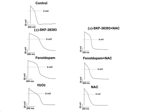 Ros Mediated The Effects Of Skf Or Fenoldopam On Action