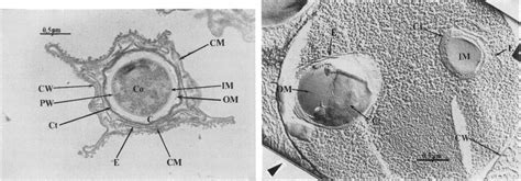 Electron Micrograph Of Ultra Thin Section Of A Sporulating Cell Cw