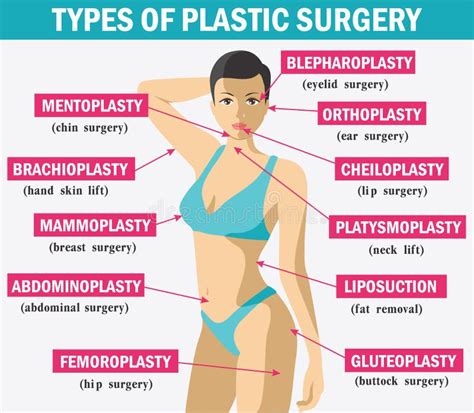 Medicine Plastic Surgery Infographics. Types of Plastic Surgery Stock ...