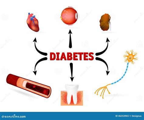 Complications Of Diabetes Mellitus Stock Vector - Illustration of blood ... 