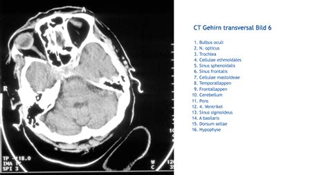 CT SHT, Bild 06