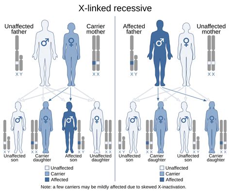 X Linked Severe Combined Immunodeficiency Wikipedia