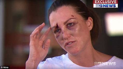 Single Mother Viciously Bashed After Sticking Up For Her Gay Friend Daily Mail Online