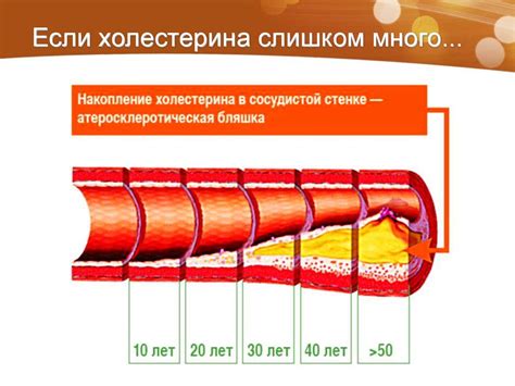 Повышенный холестерин: зачем и как с ним бороться - online presentation