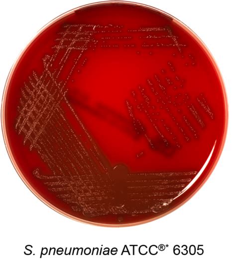 Columbia Agar Sheep Blood