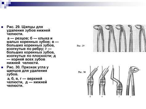 Операция удаления зуба - презентация онлайн