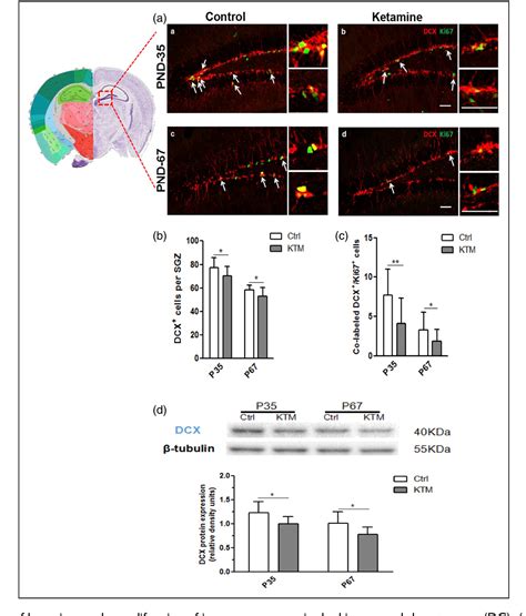 Figure From Implication Of Microglia In Ketamine Induced Long Term