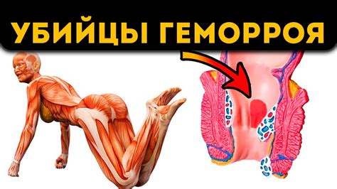 Проктолог промолчит! Эти 6 простых поз и упражнений, избавляют от ...