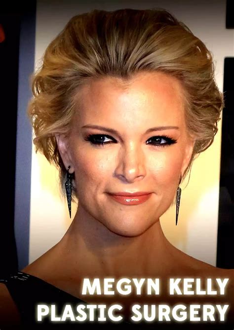Megyn Kelly Plastic Surgery Cosmetic Town