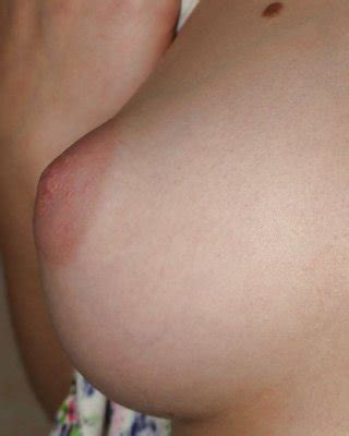 Tits Puffy Nipples Lovely Areolas Porn Pictures XXX Photos Sex Images 3830350 PICTOA