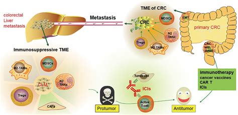 Emerging Role Of Immunotherapy For Colorectal Cancer With Liver Metast Ott