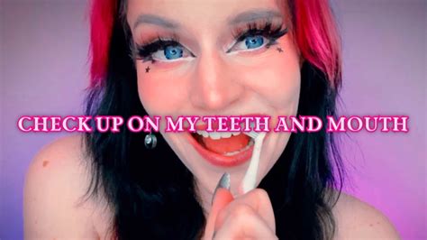 Vip Many Vids Max Starry Yume Check Up On My Teeth And Mouth