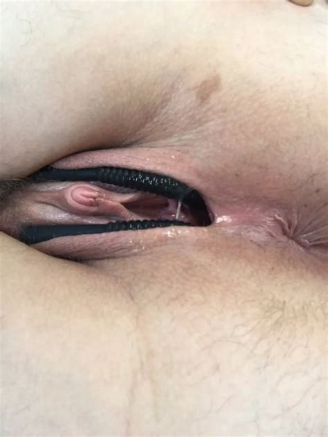 Schamlippenspreizer 23 Nude Pics XHamster