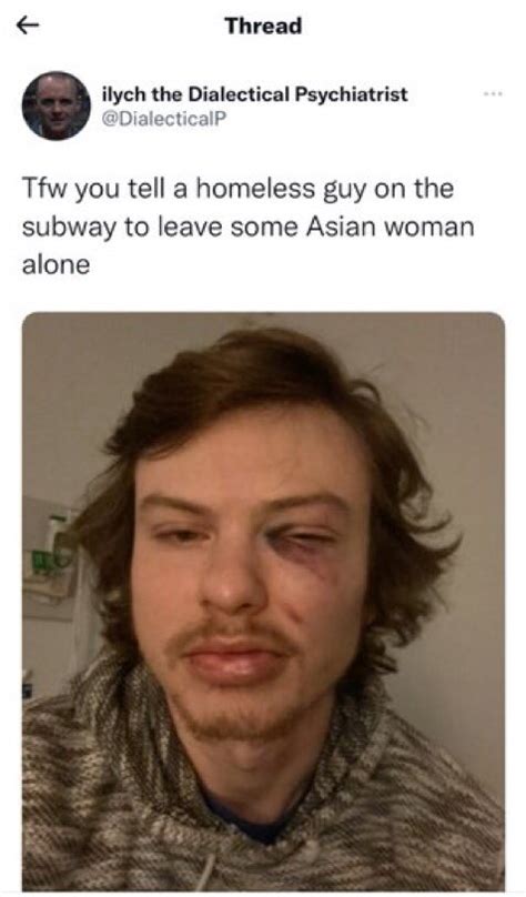 Marxist Lynchist On Twitter Posting Yourself After Getting Your Ass Beat Even Worse Than