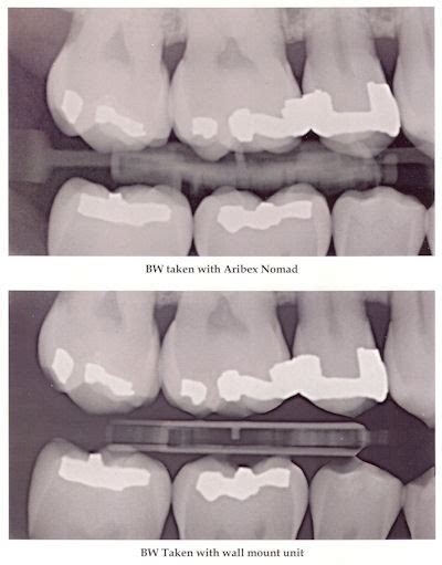 australia dental: Studies show Nomad portable x-ray system safe