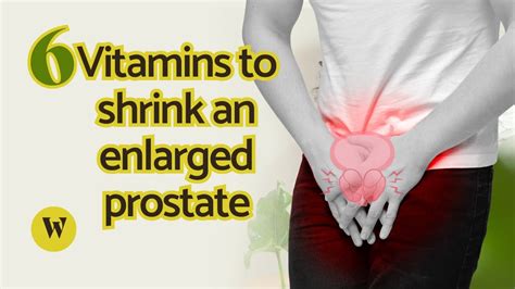 Top Vitamins To Shrink An Enlarged Prostate Youtube