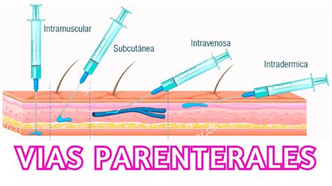 Vias De Administração De Medicamentos Parenterais