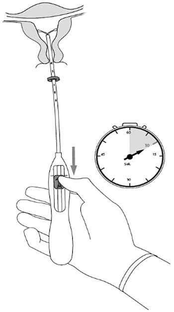 Кайлина ЛНГ инструкция по применению: показания, противопоказания ...