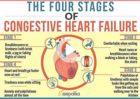 Heart Failure Life Expectancy