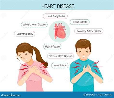 El Hombre Y La Mujer Tienen Síntomas De Dolor Torácico Diferentes Tipos