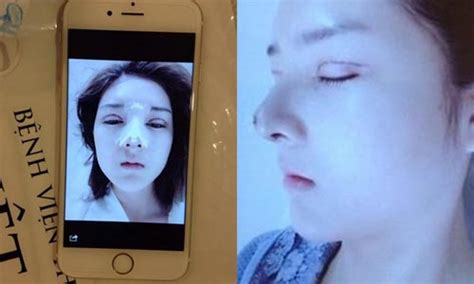 Lilly Luta Hot girl Lilly Luta trước và sau phẫu thuật