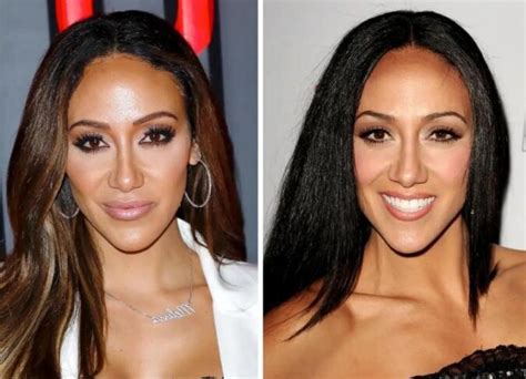 Melissa Gorga S Plastic Surgery Examining The Real Housewives Star S