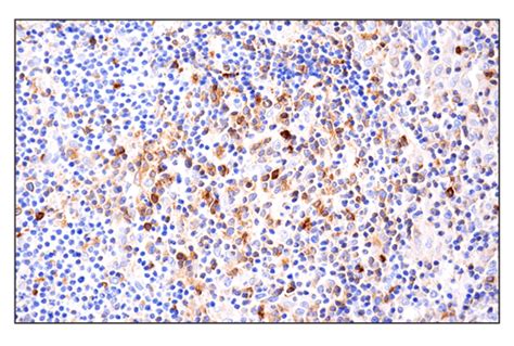 Phospho SLP 76 Ser376 E3G9U XP Rabbit MAb BSA And Azide Free