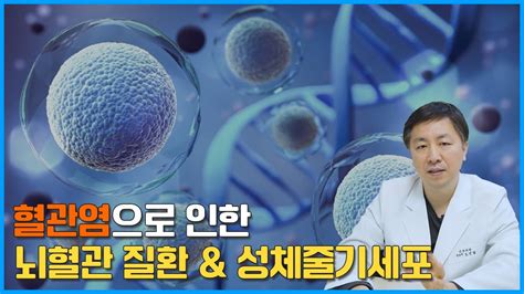 혈관염으로 인한 뇌혈관질환 줄기세포 치료 전 후 Youtube