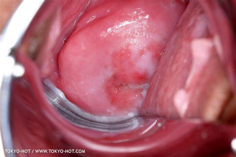 Tokyo Hot N0598 Set2 Natsumi IIjima 1120 Porn Pic