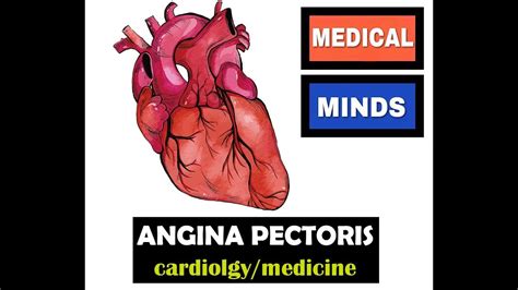 Stable Angina Pectoris Cardiology Youtube