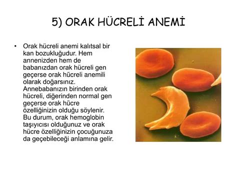 Ppt Genet K Hastaliklar Akraba Evl L Powerpoint Presentation