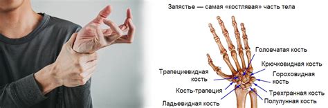 Почему болит запястье | Сеть клиник «ЗдравКлиник»