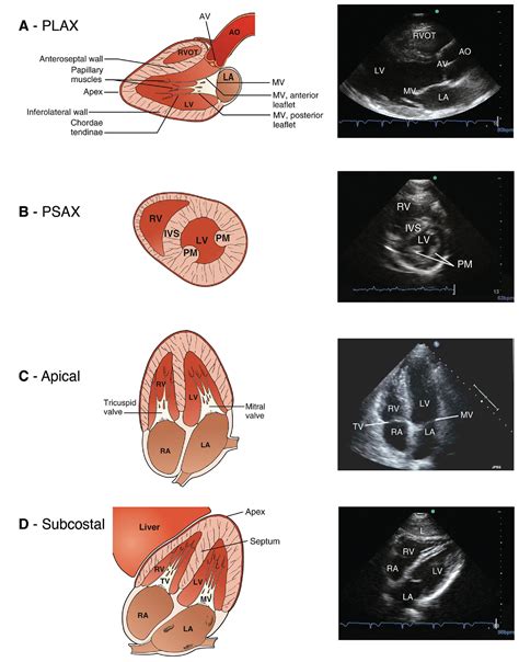 POINT-OF-CARE ULTRASOUND - Clinical Tree