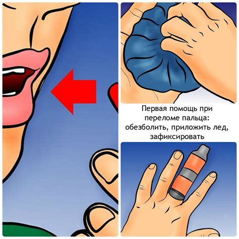 Перелом мизинца или большого пальца на руке: как определить и что делать?