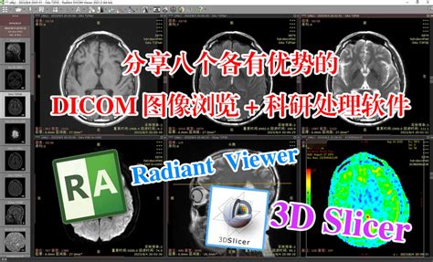 Dicom 图像浏览器和影像科研平台推荐（附 Radiant Viewer、3d Slicer 安装包） 知乎