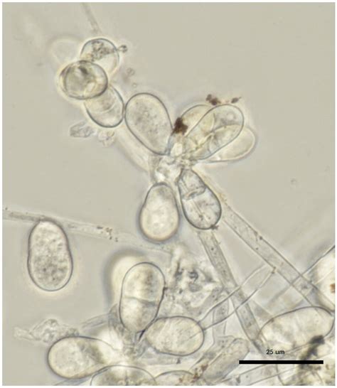 Aquatic fungi: Forgotten conservation targets