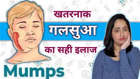 Home Remedies For Mumps गले की सूजन या गलसुआ के घरेलू उपाय कंठमाला का इलाज Mumps Treatment