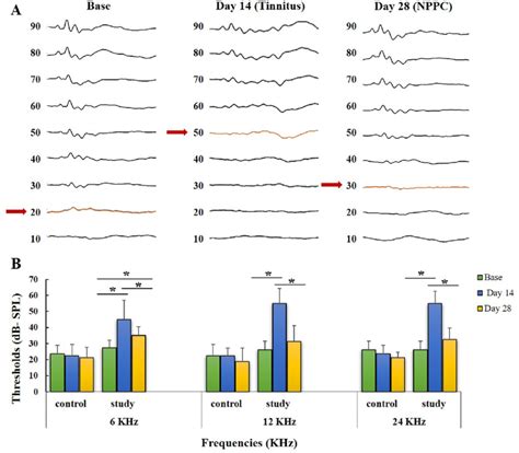 The Effects Of The Ss And The Nppc On The Abr Hearing Threshold Shift