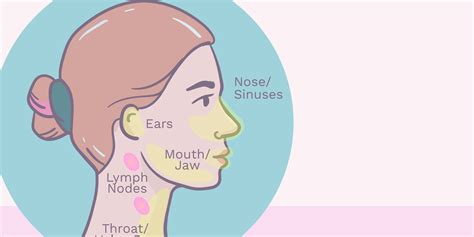 Síntomas de cáncer de cabeza y cuello Vitafluxs