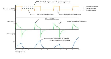 Practical Differences Between Pressure And Volume Controlled