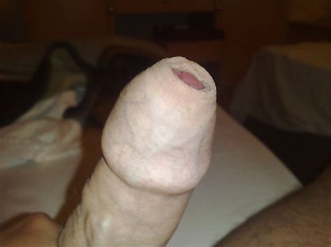 Bondage Cock Pee Hole Stretch Porn Pictures XXX Photos Sex Images 32664 PICTOA