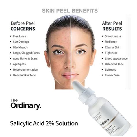 The Ordinary Niacinamide 10 Zinc 1 30ml Skin Care The Ordinary