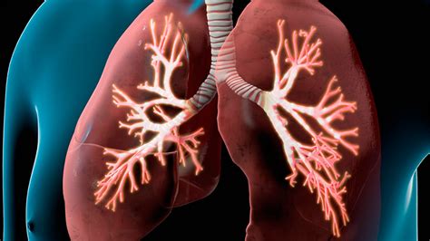 Enfisema Pulmonar O Que É