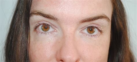 L Oreal Paris Nude Magique Blur Cream Review With Before After Pictures Really Ree