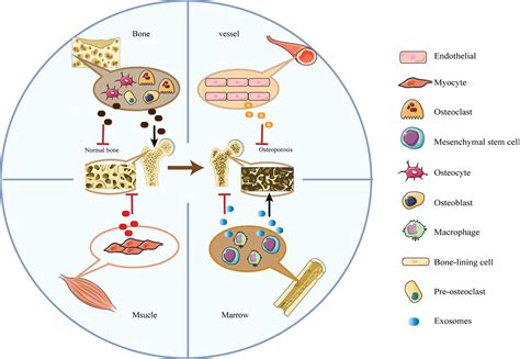 Frontiers Exosomes A Friend Or Foe For Osteoporotic Fracture