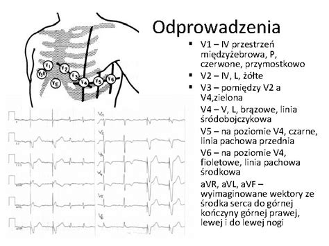 Jak Odczyta Wynik Ekg Monika Kujdowicz Odprowadzenia V