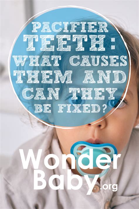 Pacifier Teeth What Causes Them And Can They Be Fixed