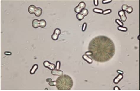 Urinalysis - Microscopic (Renal) Flashcards | Memorang | Medical ...